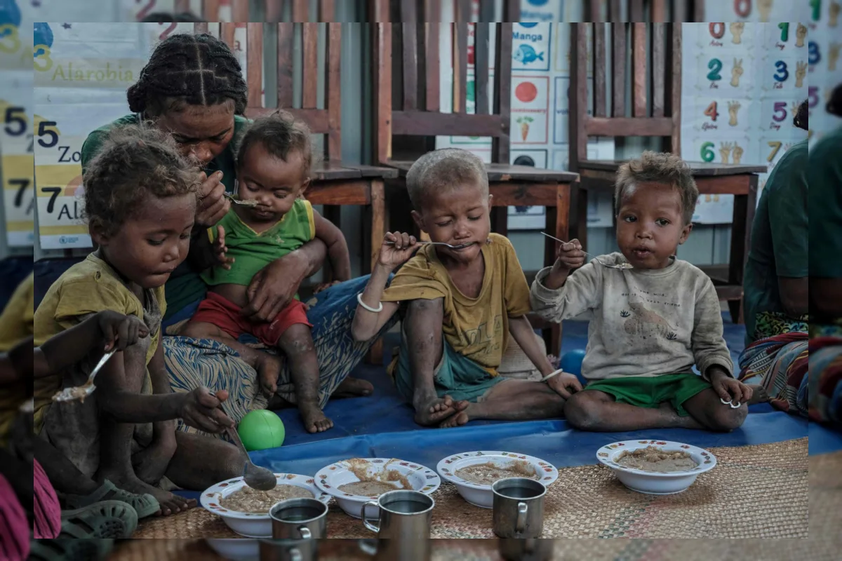 Anak-anak mengikuti program rehabilitasi malnutrisi di pusat Ifotaka