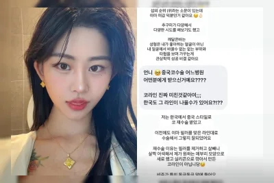 Operasi Hidung ala China? Selebriti TV Korea Ini Bikin Penasaran