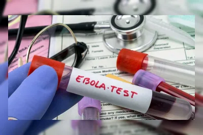 PBB: Wabah Ebola Berpotensi Rugikan Kongo US$1 Miliar