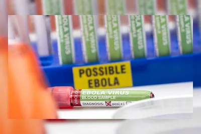 Pasien Ebola Pertama di Prancis Sembuh dan Dipulangkan