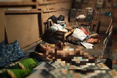 Miris, Warga Berkebutuhan Khusus di Pandeglang Tak Kuasa Berobat Pakai BPJS