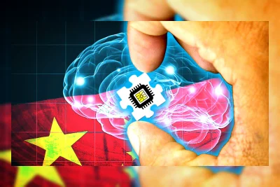 China Klaim Berhasil Tanam Implan Otak Komersial Pertama di Dunia