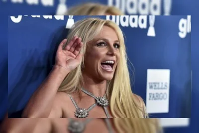 Kelopak Mata Britney Spears Sempat Turun gegara Botox