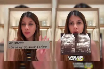 Profil Fahira Mira, TikToker yang Diduga Black Campaign RS Indonesia
