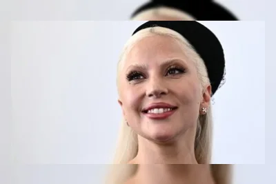 Lady Gaga Dikabarkan Lewati Perjuangan Fisik Berat Sebelum Jadi Ibu