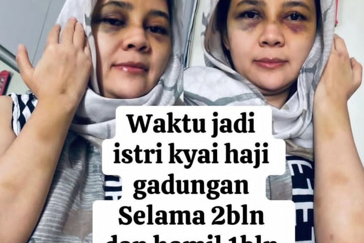 Selisih Umur Zaky Mubarok Al-Madinah dan Suila Rohill Berapa? Inilah Biodata Singkat Sosok Ustadz yang Diduga Lakukan KDRT pada Mantan Istri