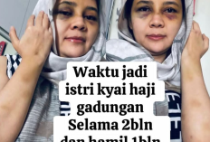 Biodata Profil Suila Rohill Lengkap dari Umur, Agama dan Akun IG, Mantan Istri Zaky Mubarok Al-Madinah yang Diduga Alami KDRT
