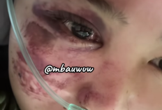 Kabar Duka! TikToker Plumpang Mabk Uwu Pendukung Ganjar Pranowo Mengalami Kecelakaan Tragis Motornya Menabrak Tembok