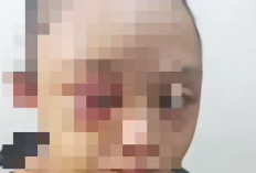 Biodata Tampang VW Sosok Ponakan Citra Hadayani yang jadi Korban Penganiayaan, Lengkap dari Umur, Agama dan Akun Instagram 